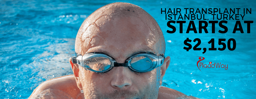 Hair Transplant in Istanbul, Turkey Starts at $2,150